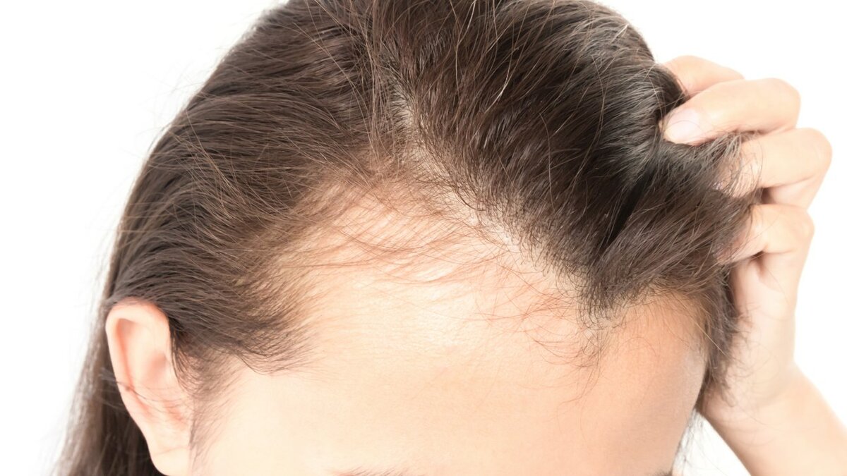 Длительность сезонного выпадения волос