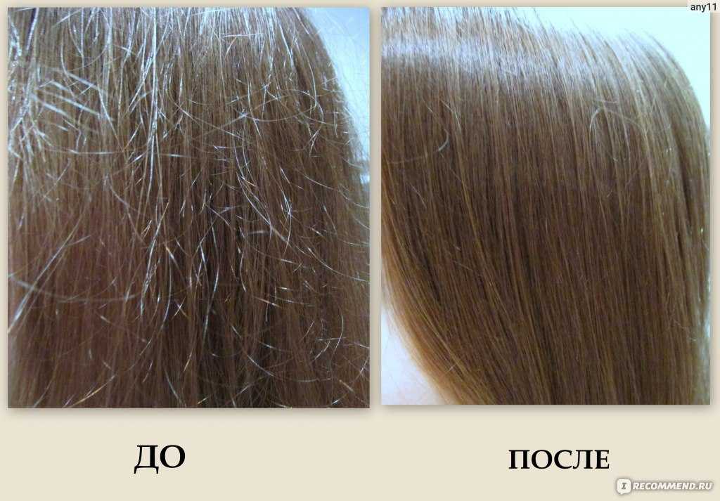 Помогает ли репейное масло от выпадения волос, насколько оно эффективно