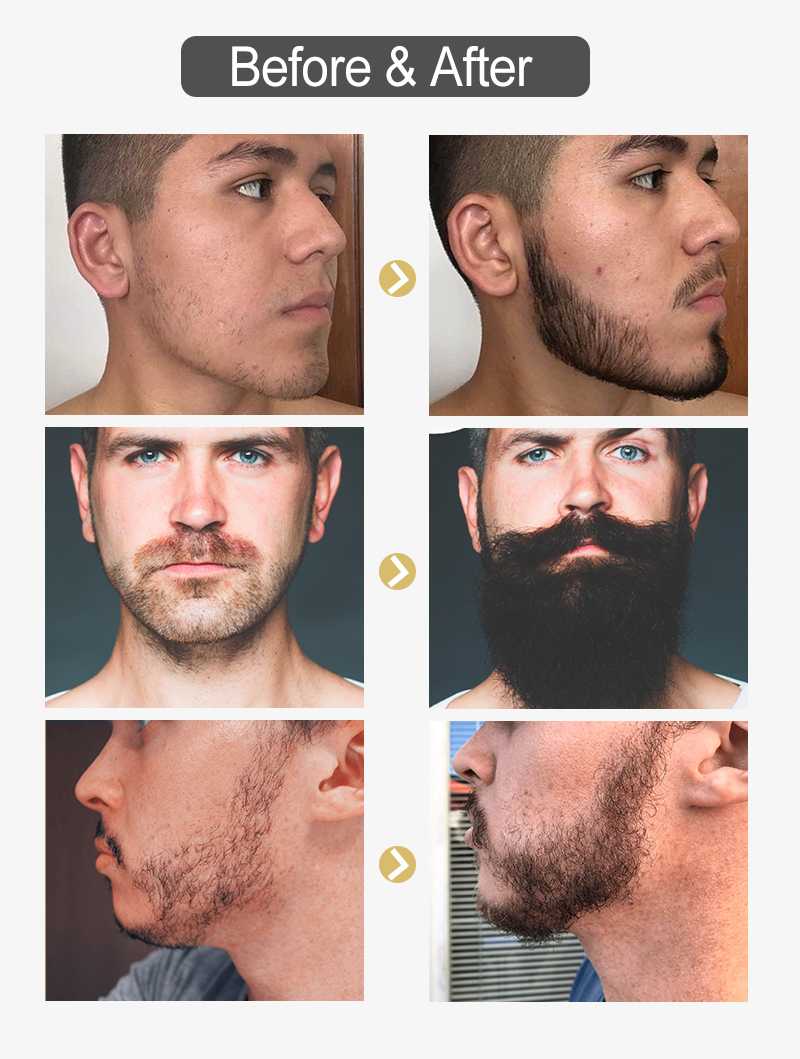 Рост бороды по дням