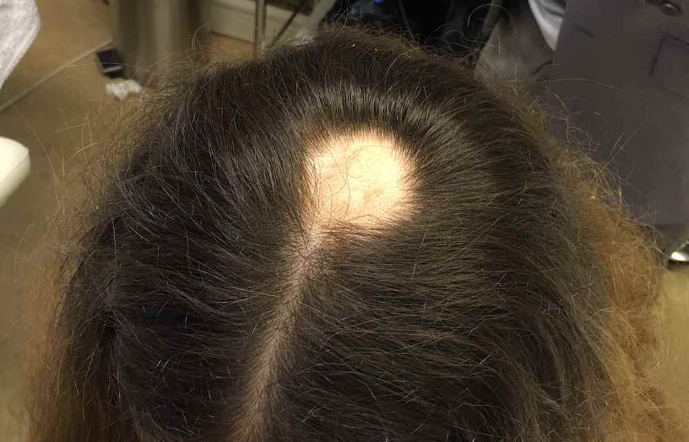 Почему волосы на голове женские