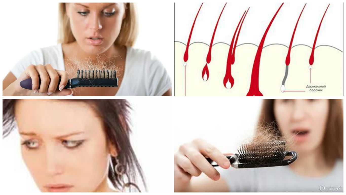 9 основных причин, почему выпадают волосы у девушек