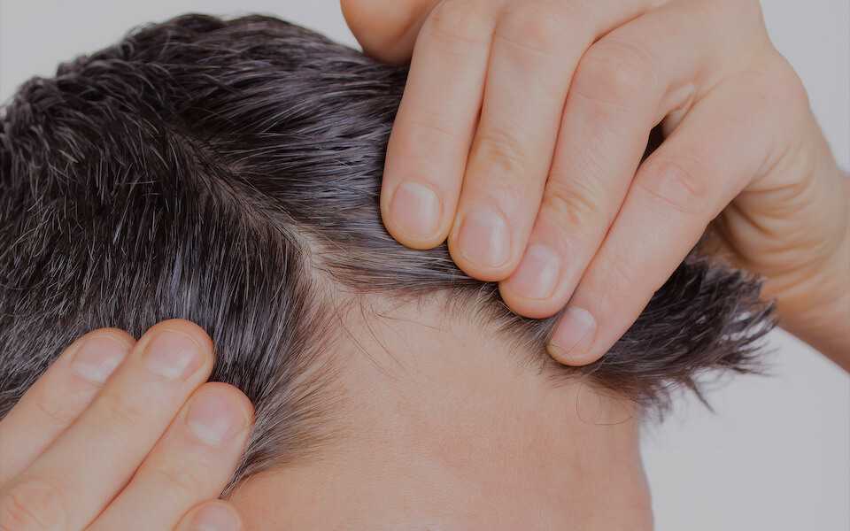 Популярные средства от выпадения волос: выбираем самое эффективное