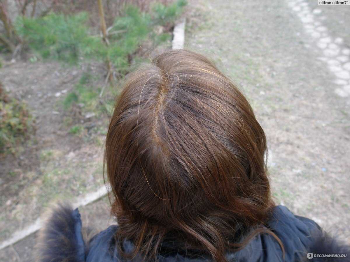 Что такое тоник для волос и как им правильно пользоваться? фото до и после применения средства