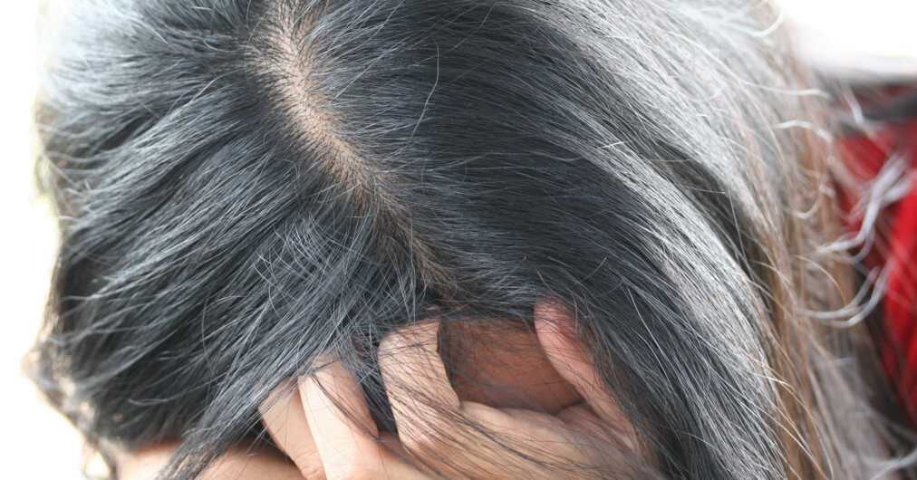Несколько способов остановить появление седых волос. как остановить поседение волос, лучшие методы борьбы с сединой