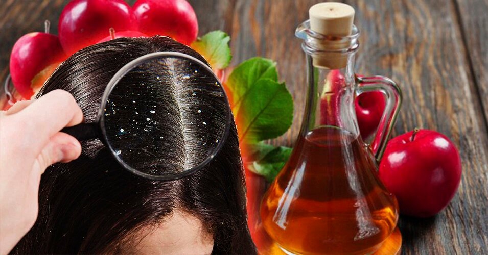 Как ополаскивать волосы яблочным уксусом