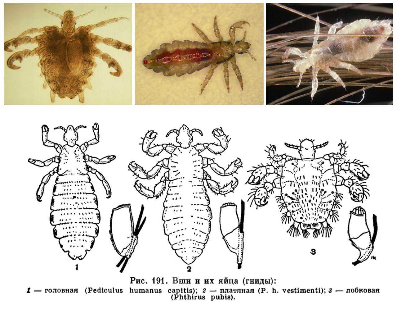 Виды вшей картинка