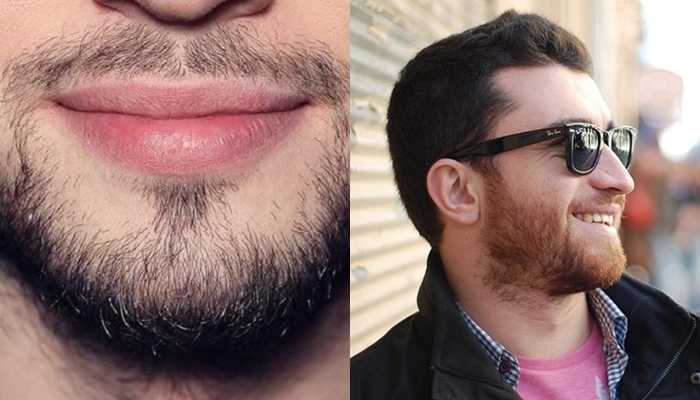 Как сделать так чтобы борода росла медленнее