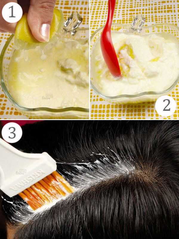 Как избавится от перхоти и как отрастить волосы