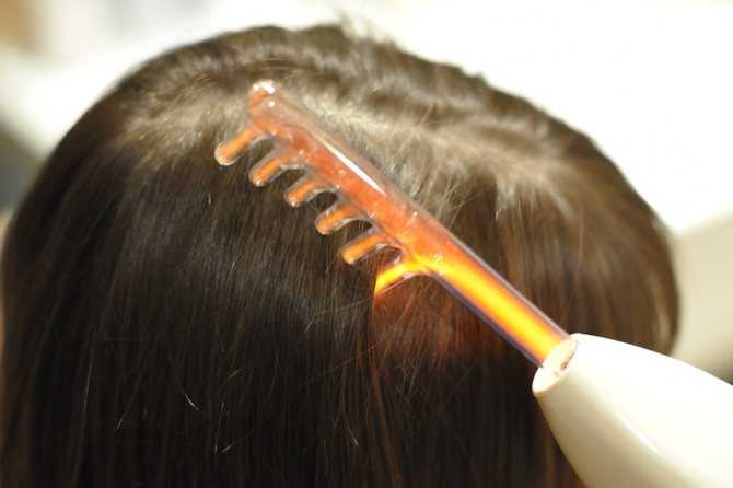 Дарсонваль для волос — как пользоваться, обзор лучших