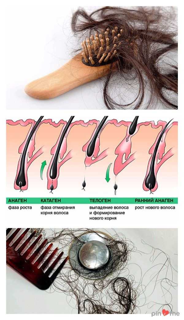 Норма выпадения волос в день: у женщин и мужчин, сколько должно выпадать в сутки волос у человека, при расчесывании, при мытье головы