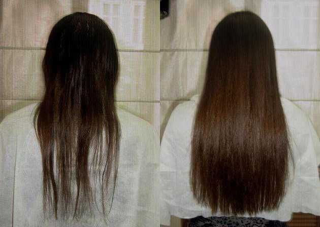Рост волос. как ускорить рост?