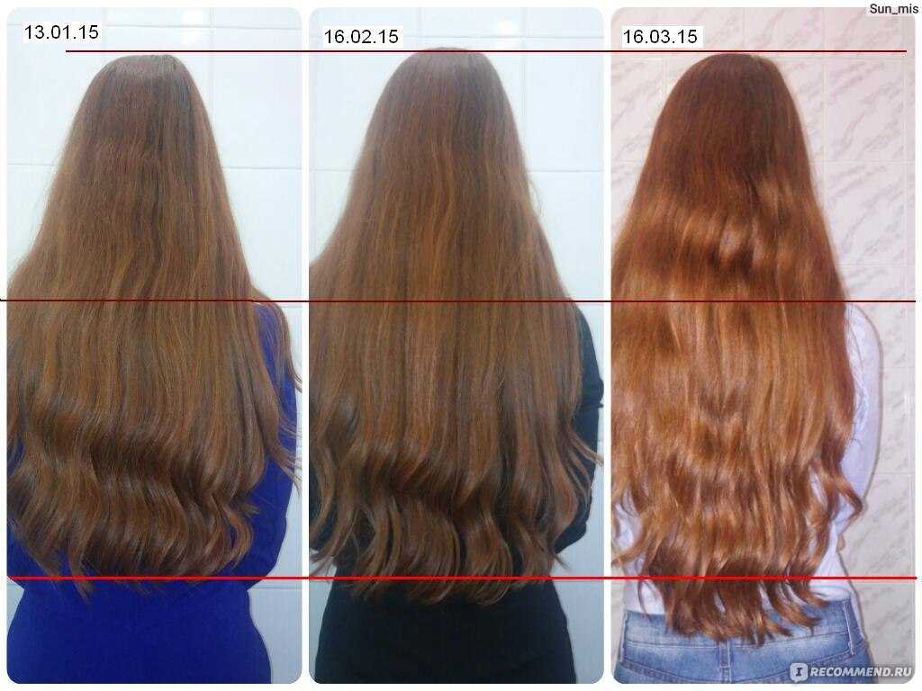 Ускоряем рост волос в домашних условиях
