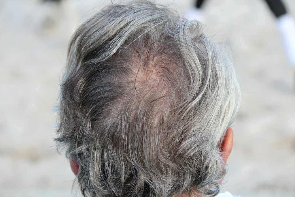 Седой волос у ребенка 7 лет причины и лечение