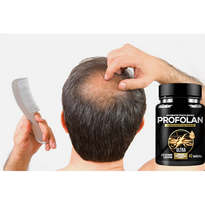 Топ-6 средств для восстановления волос у мужчин