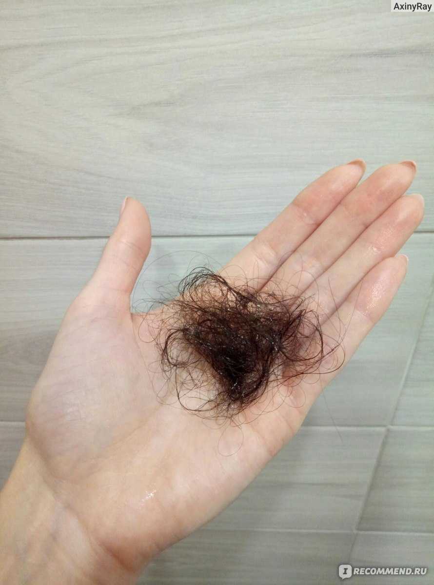 Как определить норму выпадения волос в день у женщин