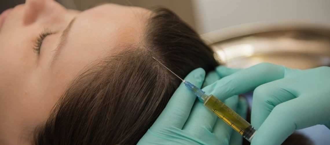 Лучшие препараты для мезотерапии волос (коктейли, витамины, лосьоны)