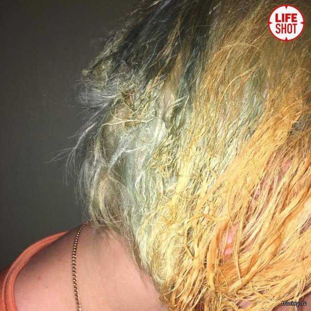 Девушка сожгла волосы краской эстель