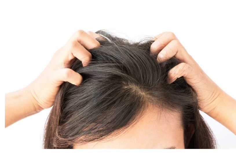 Выпадение волос при стрессе
