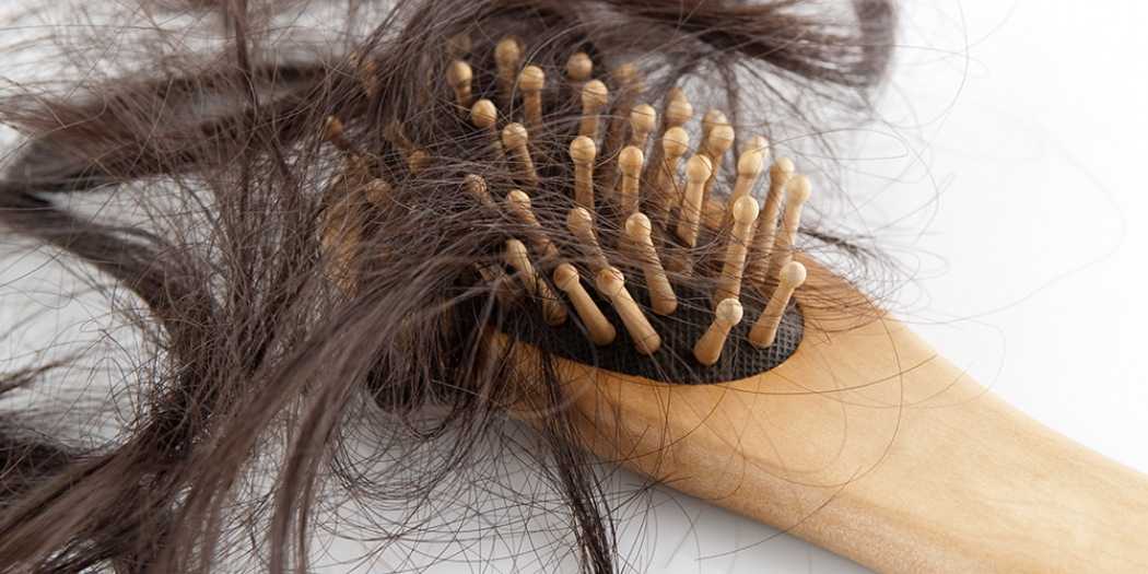 Алопеция (облысение): что делать если выпадают волосы?