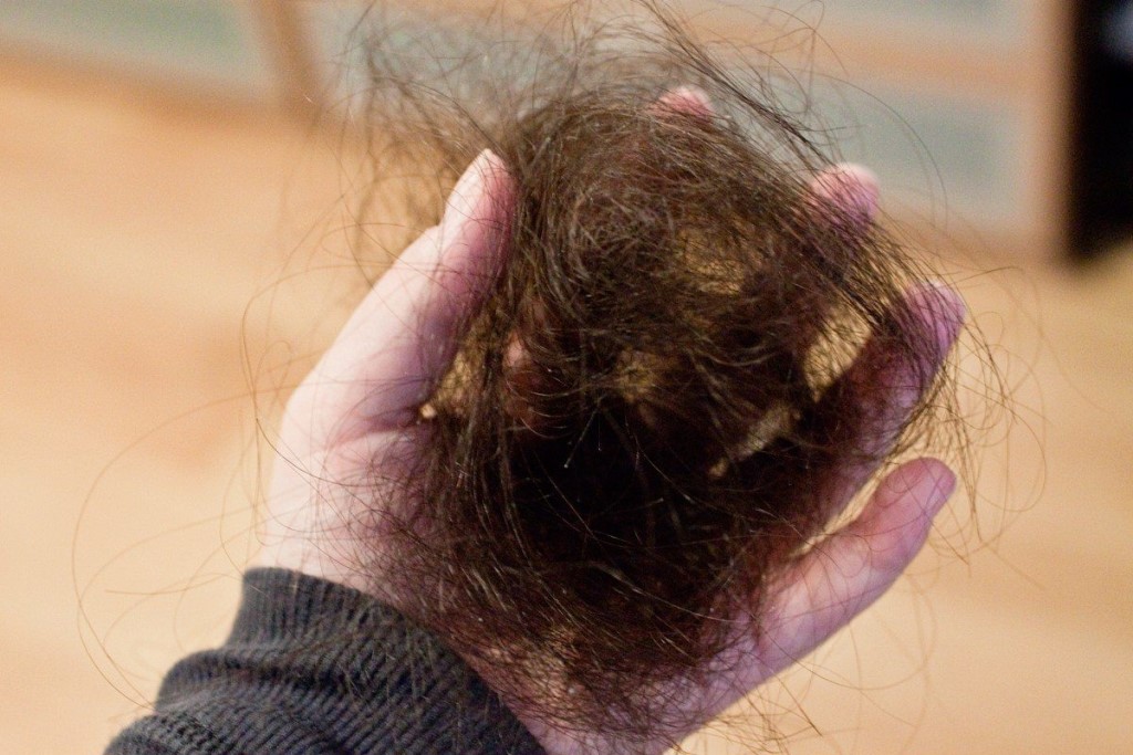 Норма выпадения волос в день: узнаем свою норму
