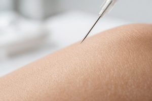 Мезотерапия для лица: принципы и результаты процедуры