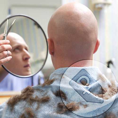 Мужская стрижка под ноль: как подстричься налысо и почти наголо