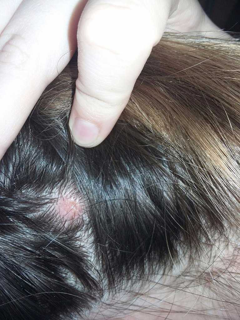 20 болезней кожи головы: симптомы заболевания волос и лечение волосяного покрова