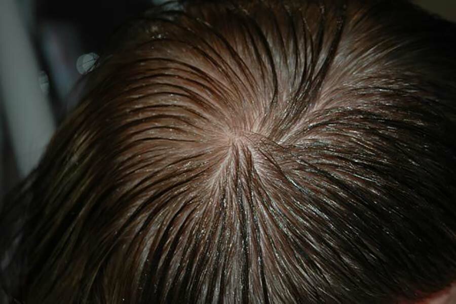 Почему волосы у корней быстро пачкаются волосы