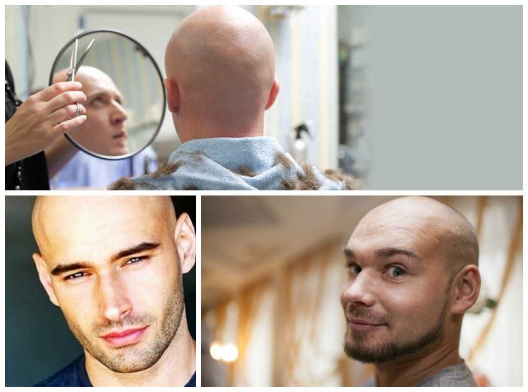 Побриться налысо: плюсы и минусы жизни без волос на примере знаменитостей