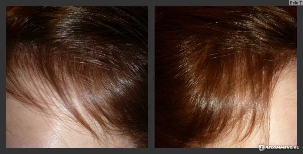 Восстановление густоты волос отзывы. Восстановить густоту волос. Густота волос 6 см фото. Густота волос 7. Как вернуть густоту волос.