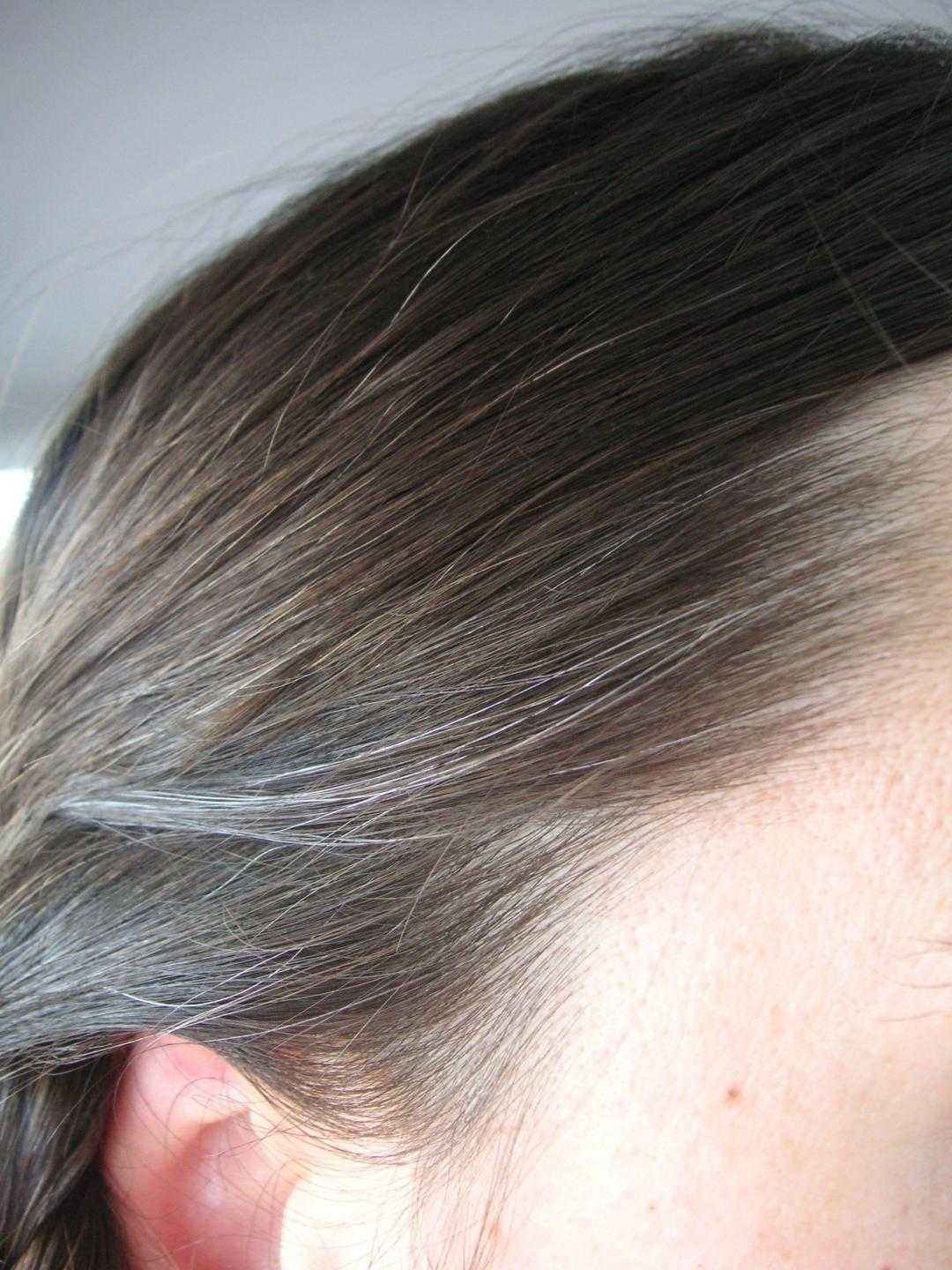 Основные причины появления седых волос у женщин