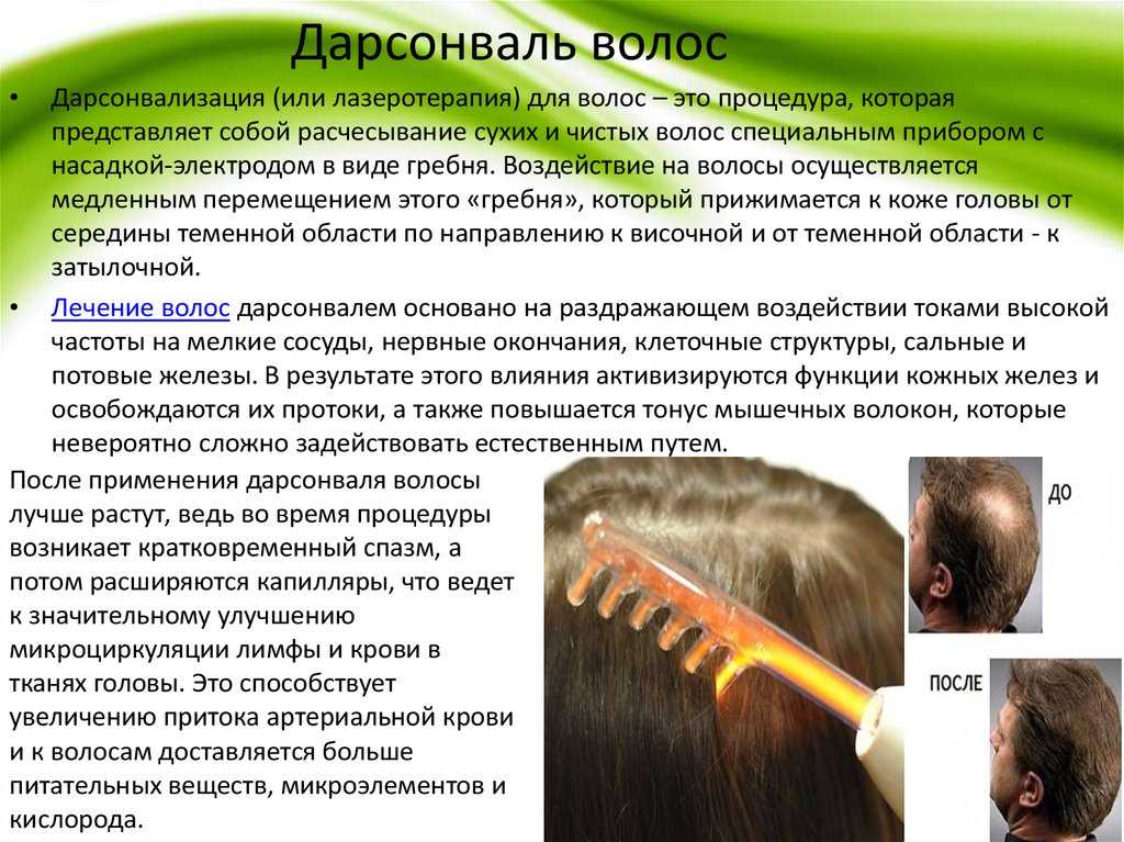 Как применять «дарсонваль» при выпадении волос