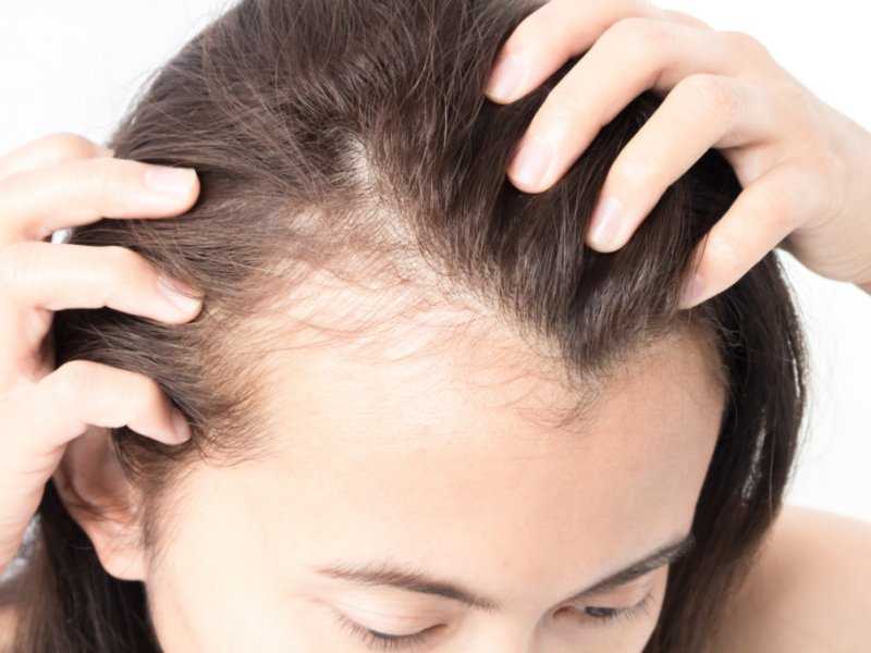 Выпадают волосы после окрашивания? – этого легко можно избежать