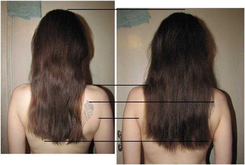 Никотиновая кислота инструкция для волос: форма производства, способы применения