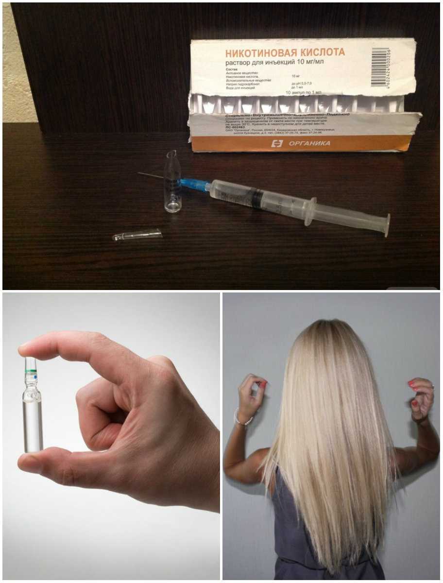 Все способы применения никотиновой кислоты для волос