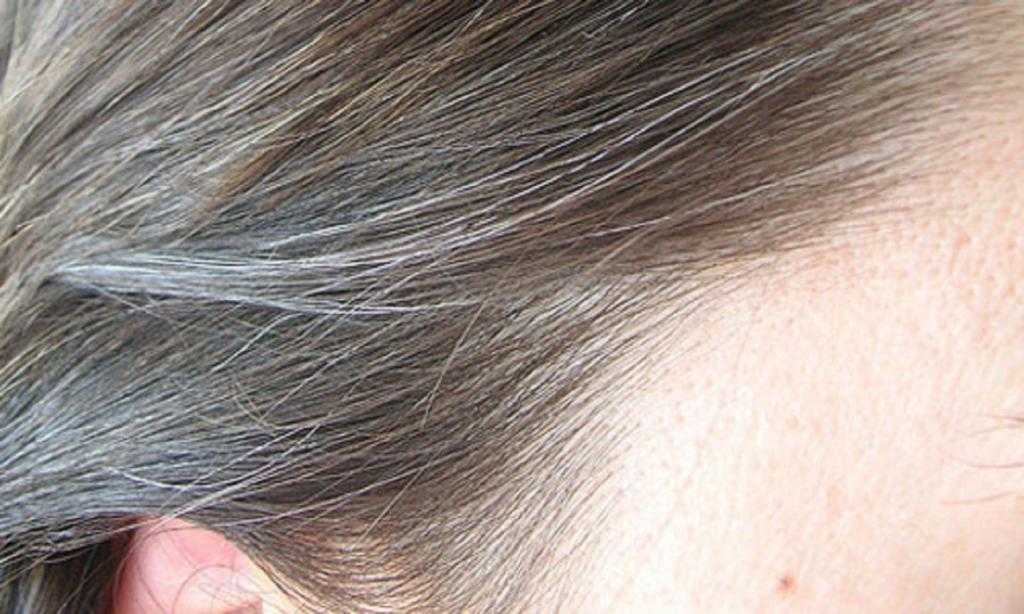 Причины появления седых волос у ребенка