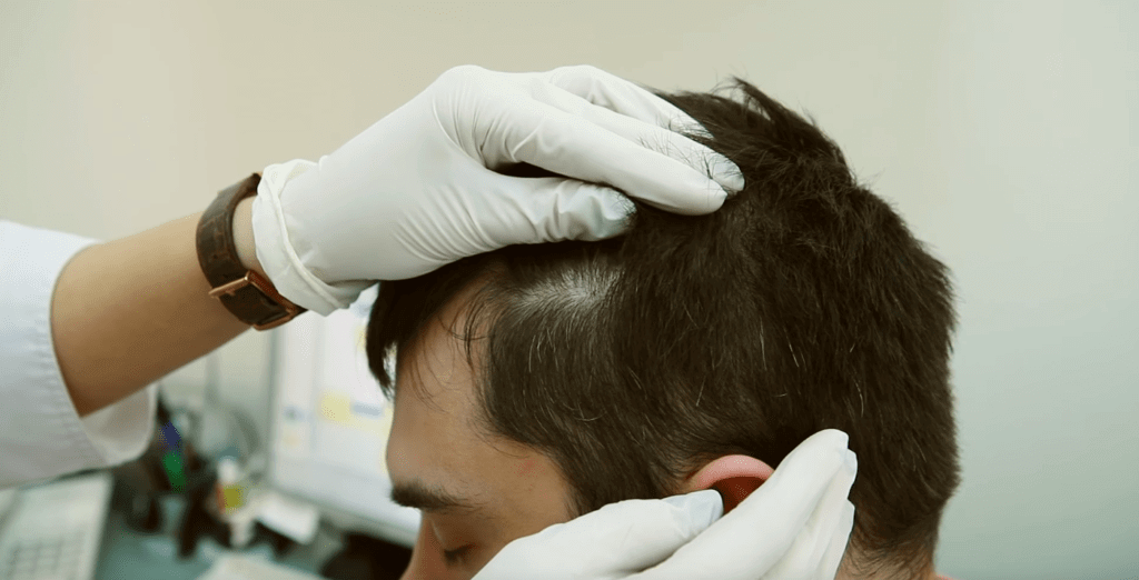 Как сохранить здоровье кожи головы и волос: правильный уход и полезные советы