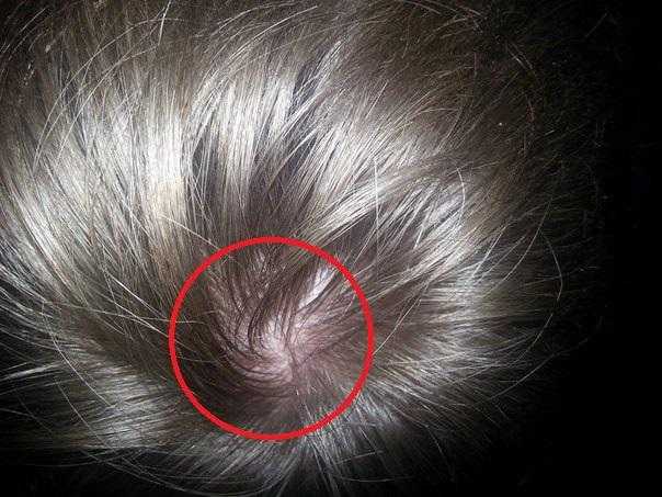 Почему болят корни волос: причины, лечение и профилактика