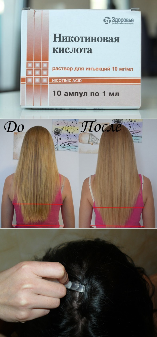 Никотиновая кислота для волос применение