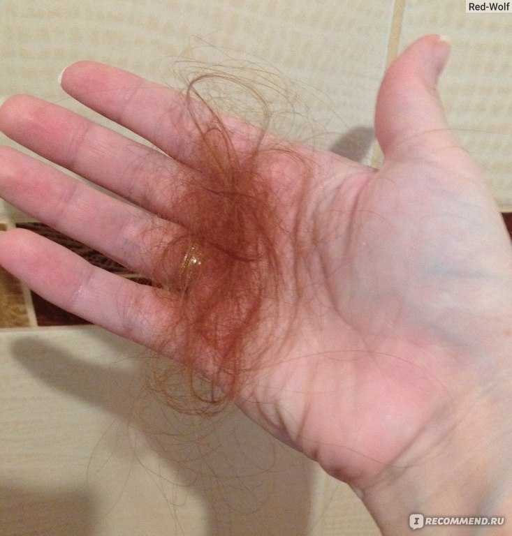 Что делать, если выпадают волосы после родов?