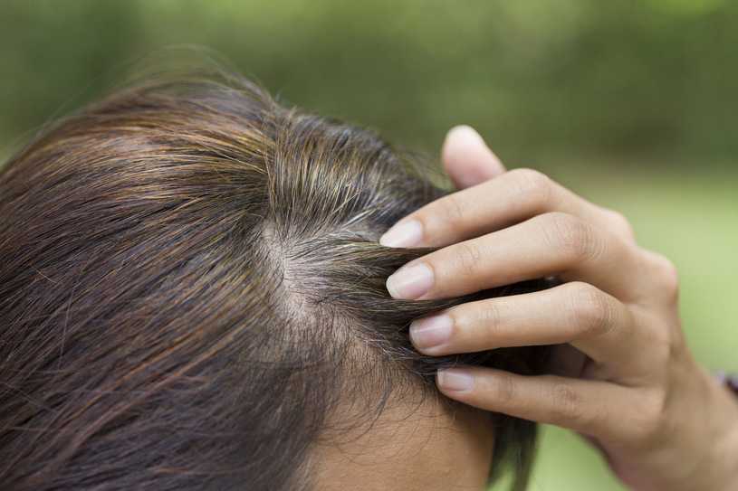 Если болят корни волос на голове: причины