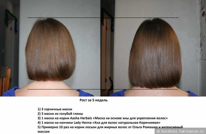 Бадяга для роста волос на голове: полезные свойства, правила использования и рецепты масок
