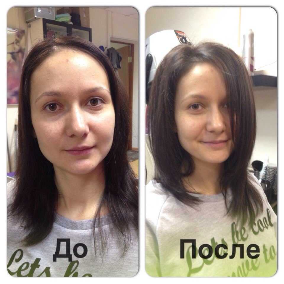 Буст ап для волос. фото до и после, как делается bust up прикорневой объем, последствия процедуры