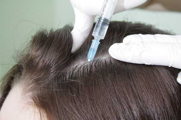 Особенности процедуры и показания к применению криомассажа головы