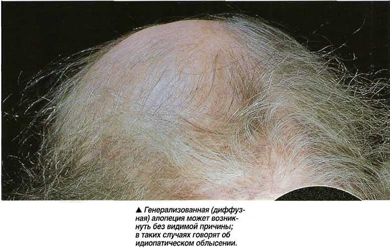 Средства от выпадения волос: лучшие препараты и народные составы