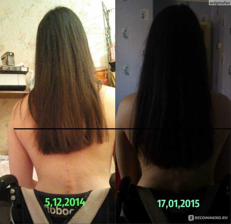 Результат масок для волос. Рост волос до и после. Дарсонваль для роста волос до и после. Дарсонваль для волос до и после. Волосы после маски.