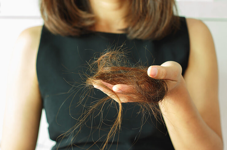 Что делать, если выпадают волосы