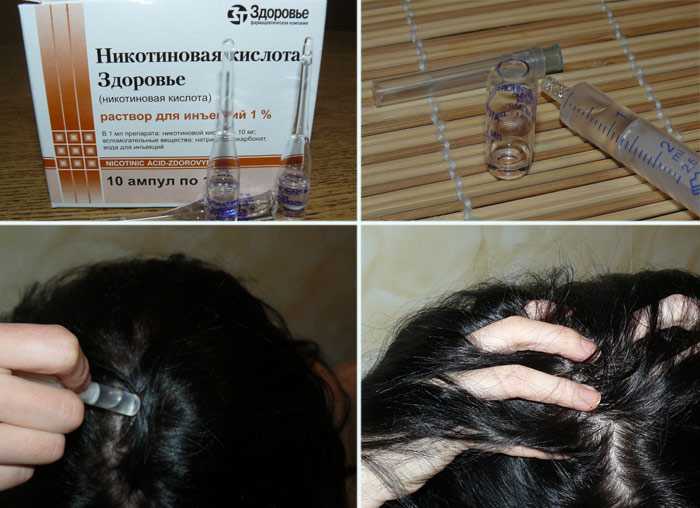 Использование никотиновой кислоты для волос в ампулах