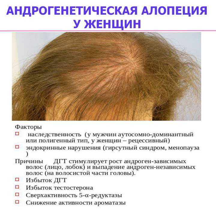 Выпадают волосы после наркоза: что делать, может ли после операции начаться потеря локонов, как остановить процесс алопеции
