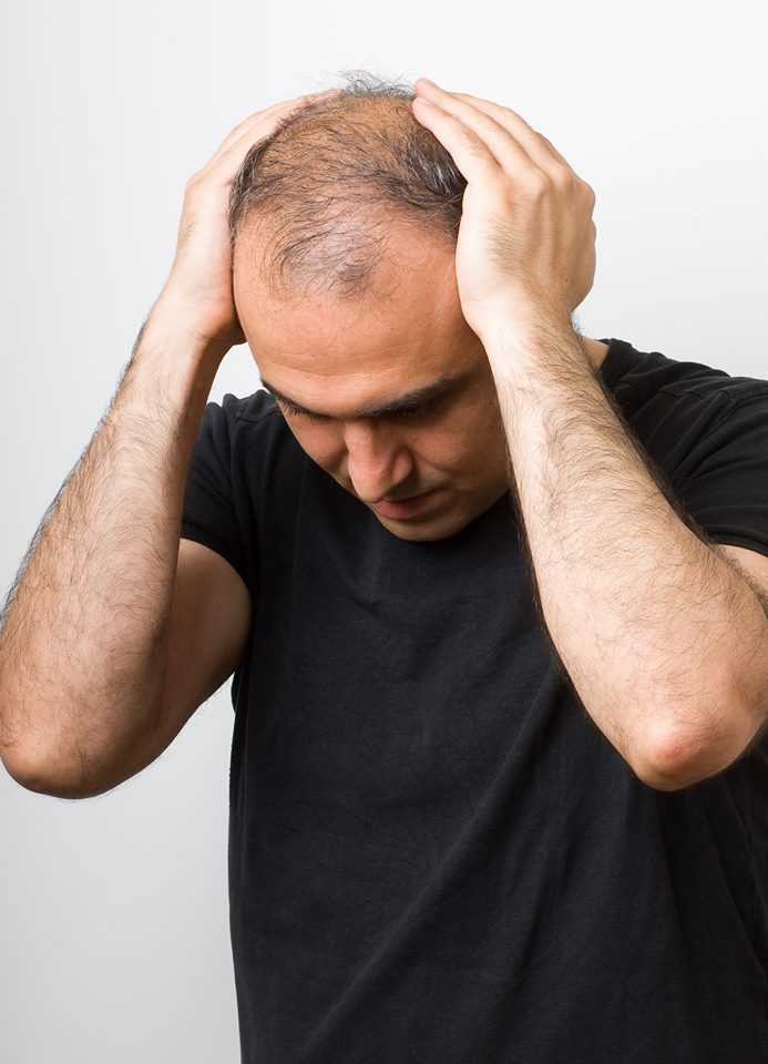 Как остановить выпадение волос у мужчины: эффективные методы и средства